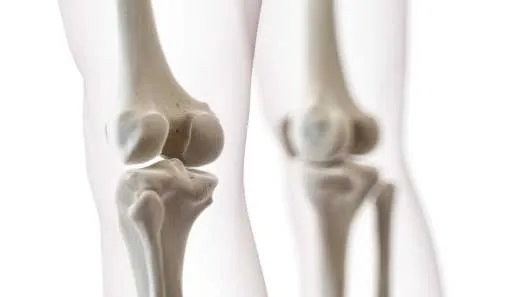 Kinematic alignment for total knee replacement