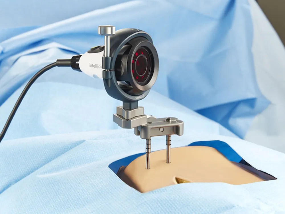 Intellijoint HIP optical surgical navigation device in use during hip replacement