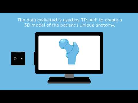 Patient Infographic Animation